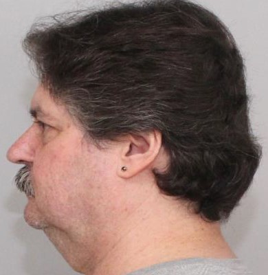 Mugshot Side